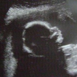 19 ������� �������� - �� ���������� � ������� � �����, ���������