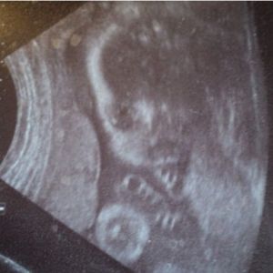 34 ����� �������� - �� ���������� � �������, ��������, ���� ������