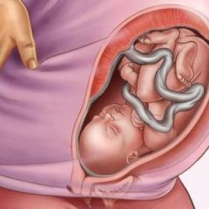 35 ������ ��������: ���� � ���� ������, ���������, ���� �����