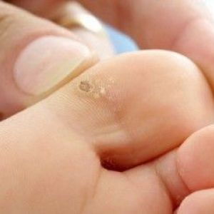 �� ��������� �� ���������: �������� � �������� ������