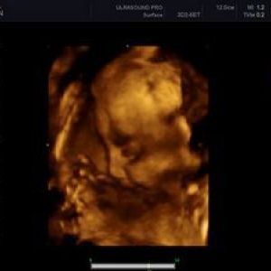 ���������� ������ 31 ����� ��������