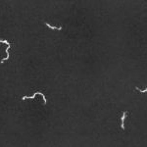 Treponema pallidum